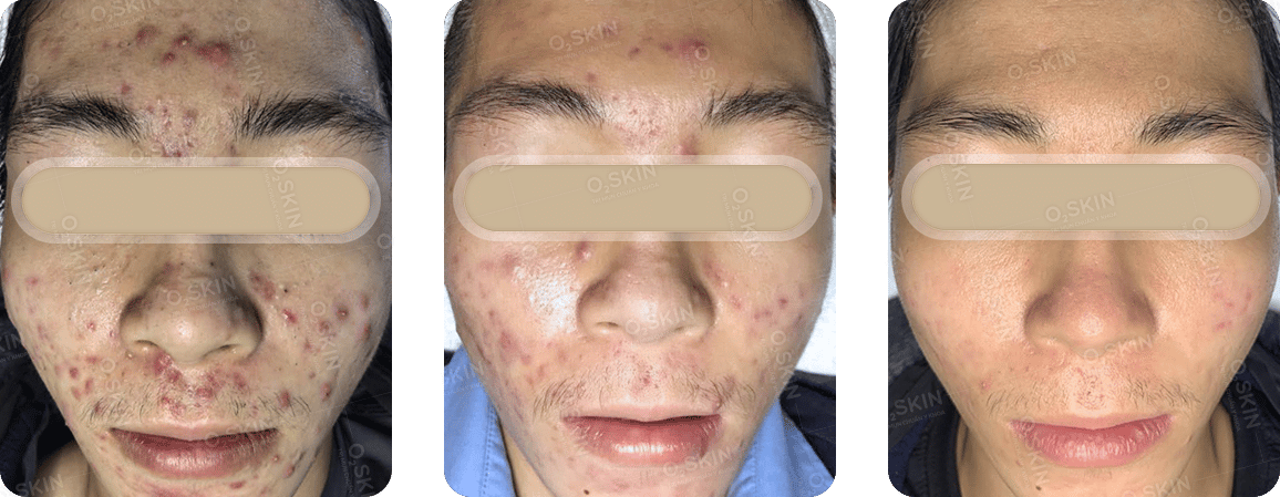 Hình ảnh khách hàng điều trị