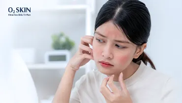 Da bị kích ứng khi đi du lịch hoặc chuyển nơi ở: Nên chuẩn bị và xử lý thế nào?